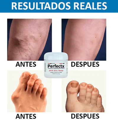 💥PERFECTX 💥- TERAPIA PARA ARTICULACIONES Y MÚSCULOS 🚀 OFERTA 2X1