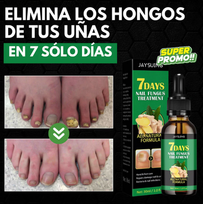 🔥50%  Serum De Crecimiento Y Reparación De Uñas En 7 Días 💅✨