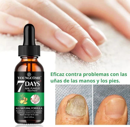 🔥50%  Serum De Crecimiento Y Reparación De Uñas En 7 Días 💅✨