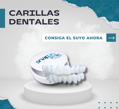 🦷Carillas Dentales🦷