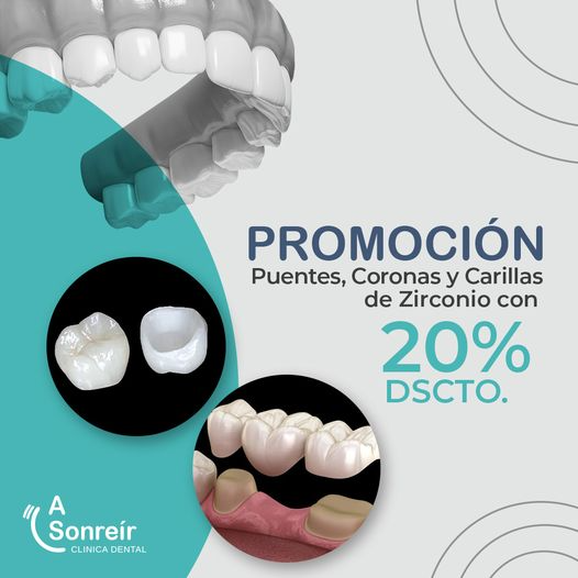 🦷Carillas Dentales🦷