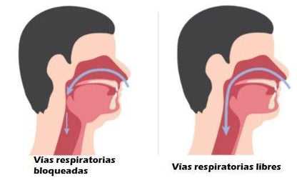 Dispositivo Anti Ronquidos